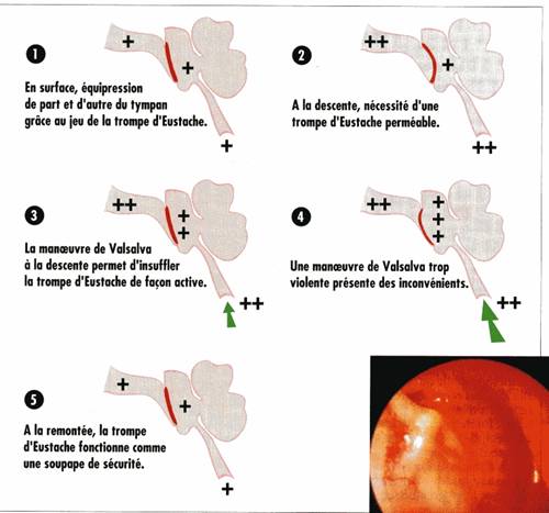 Fig. 15 - Pression sur la Trompe d'Eustache en Plongée